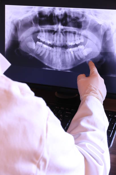 Best Emergency Tooth Extraction in Millsboro, DE